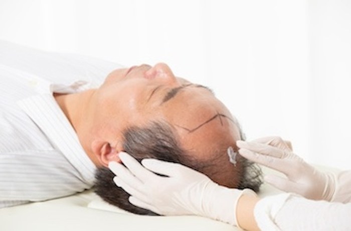 Hair Restoration